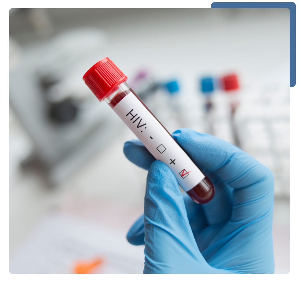 A healthcare professional conducting an HIV blood test, showcasing the testing equipment and sample collection process.