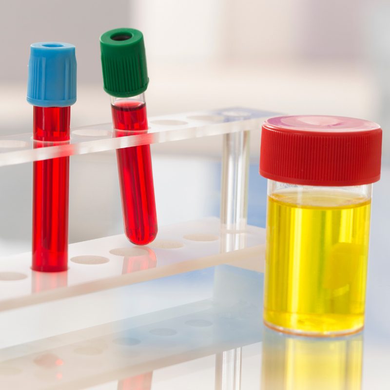 Blood Test at Home in Dubai