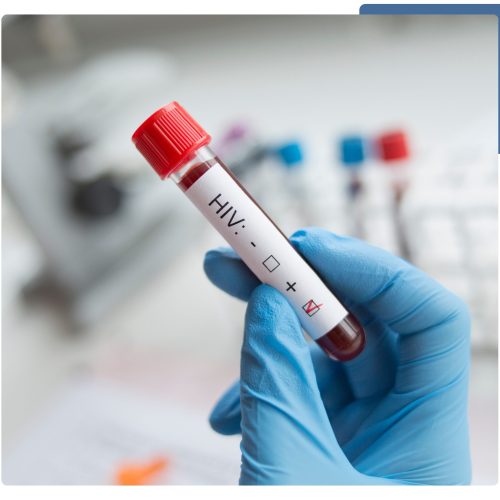 A healthcare professional conducting an HIV blood test, showcasing the testing equipment and sample collection process.