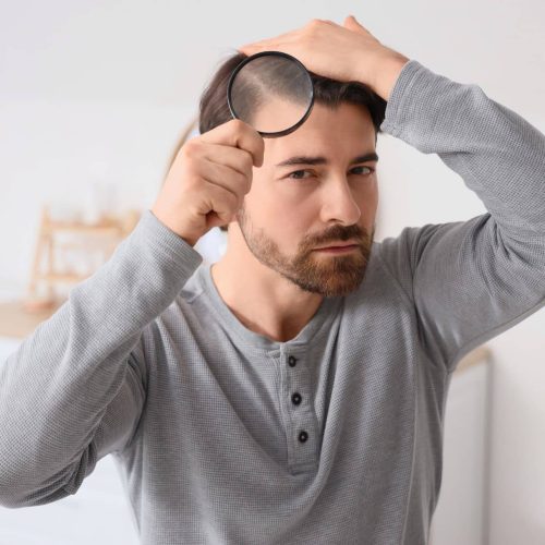 ANTI-HAIR LOSS DRIP (50ML)